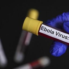Ebola alarmında "T&uuml;rkiye" sorusu: Şu anda bir risk s&ouml;z konusu değil!