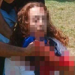 Millet Bah&ccedil;esi'nde kanlı buluşma: Boşanma aşamasındaki eşini parkta boğazından bı&ccedil;akladı