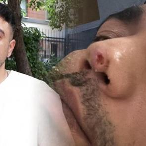 Horlama şikayeti ile başlayan 7 yıllık kabus! 