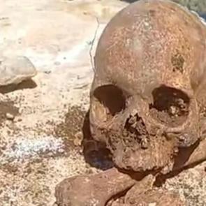 Malatya'da t&uuml;yler &uuml;rperten olay! Temel kazısı sırasında bulundu