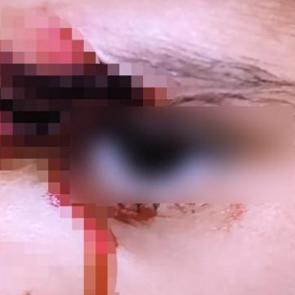 Şanlıurfa'da k&ouml;pek dehşeti! 8 yaşındaki &ccedil;ocuk kanlar i&ccedil;inde kaldı 