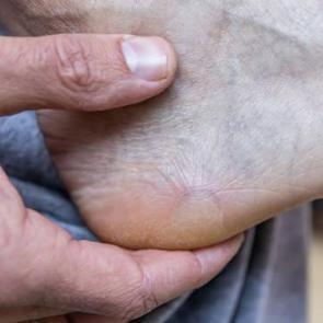 Vitrin hastalığına dikkat! Son yıllarda arttı: Sebebi ortaya &ccedil;ıktı