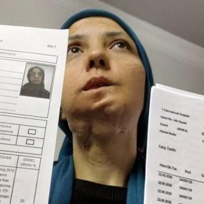 11 yılda 35 kez ameliyat oldu: 3 &ccedil;ocuk annesi kadının dili kesilebilir