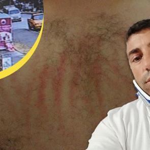 Samsun'da beyzbol sopalı pusu: Can g&uuml;venliği kalmayan aile şehri terk etti