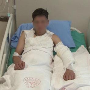 Merakı başına iş aştı! V&uuml;cudunun y&uuml;zde 25'i yandı... Kolonya şişesi bomba gibi patladı
