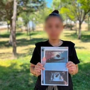 Vahim iddia: 7 haftalık hamile kadına "boş gebelik olabilir" raporu verildi