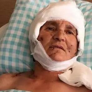 Kırşehir'de k&ouml;pek saldırısına uğrayan 63 yaşındaki kadına tazminat &ouml;denecek