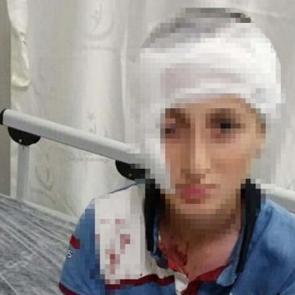 İzmir'de k&ouml;pek saldırısına uğrayan 11 yaşındaki &ccedil;ocuğa emsal niteliğinde tazminat 