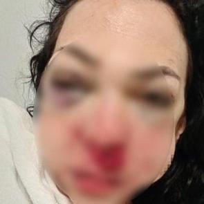 Kocaeli'de &ouml;ld&uuml;resiye d&ouml;v&uuml;lm&uuml;şt&uuml;! Tutuklu sayısı arttı 