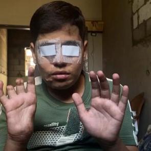 İsrail'in hayatını kararttığı Ebu Şab'ın tek bir isteği var: Yeniden okula gitmek