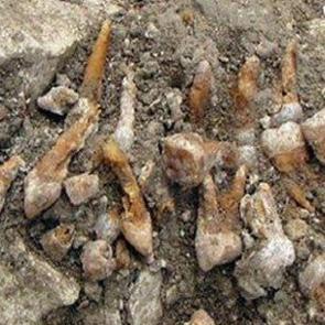 İnsanoğlunun 'ilk takma dişi'