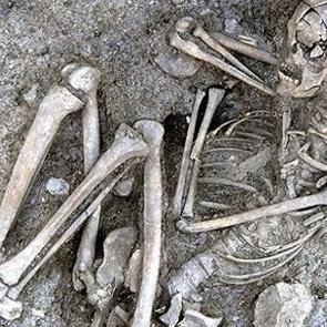 Kanser 3200 yıl &ouml;nce de vardı