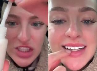 Dişlerini beyazlatmak isteyen kadının kullandığı yöntem 'yok artık' dedirtti!