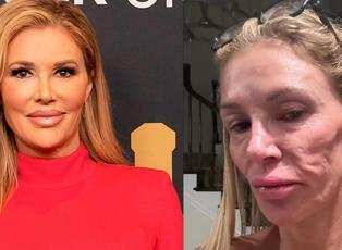 ABD'li yıldızın y&uuml;z&uuml; g&uuml;n ge&ccedil;tik&ccedil;e erimeye başlamıştı: Binlerce dolar d&ouml;kt&uuml; sorunu buldu!