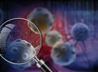 T&uuml;rkiye'de en &ccedil;ok kanser vakası g&ouml;r&uuml;len iller belli oldu! Listede ilk sıradaki şehir şaşırttı