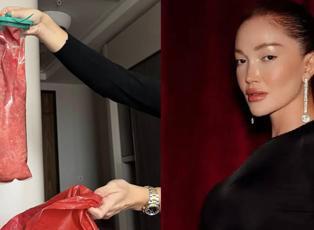 5. kez ameliyat olan Danla Bilic kal&ccedil;asından &ccedil;ıkan dolguyu paylaştı: G&ouml;renler inanamadı