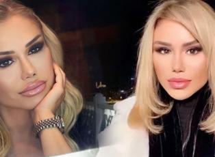 Ceylan'dan şaşırtan estetik uyarısı: Asla yaptırmıyorum!