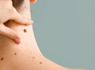 Uzman isim a&ccedil;ıkladı: &Ccedil;ocuklarda benler masum mu, risk sinyali mi? 