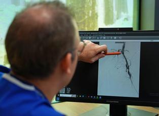 Kritik uyarı: Bacağınız kalp krizi ge&ccedil;iriyor olabilir mi?