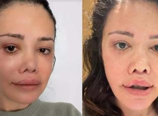 Y&uuml;z nakli olan Didem Ceran'ın gen&ccedil;lik sırrı yumurta &ccedil;ıktı!