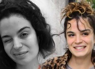 Aslı Bekiroğlu'ndan nazar isyanı: "D&uuml;z yolda d&uuml;şt&uuml;m kaslarım yırtık!"