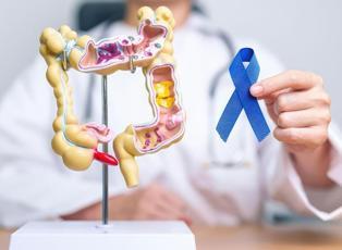 Kanser tedavisinde g&ouml;r&uuml;nmeyen destek&ccedil;i: Sağlıklı mikrobiyota
