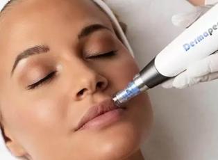 Cildi gen&ccedil;leştirmenin sırrı: Kadınların yeni g&ouml;zdesi kolajen arttıran dermapen işlemi!