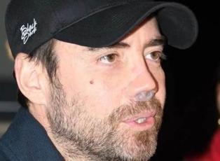 "Doktorlar hi&ccedil; şans vermiyordu!" Murat Dalkılı&ccedil; iyileşemeyen burnu ile zor g&uuml;nler yaşıyor