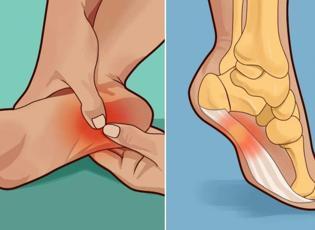 Topuk dikenine iyi gelen eczanedeki kremler hangisi?