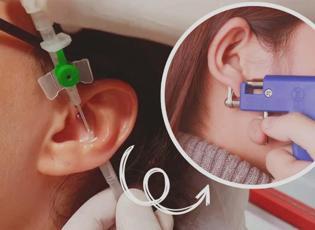 Kulak deldirme nasıl yapılır, acıtır mı? Kulak deldirme ağrısına hangi kremler sürülür?