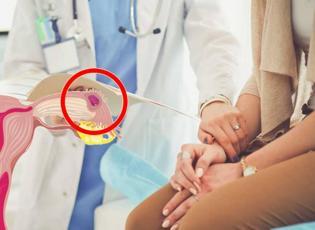 Dış gebelik nedir, dış gebelik nasıl anlaşılır? Dış gebelik riskleri ve nedenleri