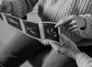 Gebelikte en çok merak edilen konu: Kız bebek belirtileri
