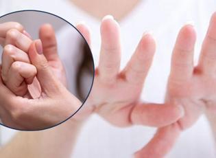 Tırnaklardaki bu belirtilere dikkat: Kansere hatta ölüme neden olabilir!