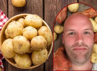 150 kilonun üzerindeydi: 1 yıl boyunca sadece patates yedi! Sonucu herkesi şaşırttı