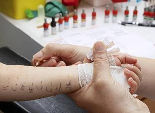 Çocuklarda alerji testi nasıl yapılır? Deri prick testi nedir?