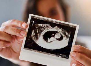 Uzman uyardı: Gebelikte 41. haftadan sonra risk artıyor!