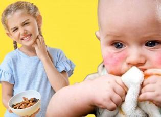 Uzman uyardı: "Besin alerjisi olan çocuklarda arkadaş ikramı hastanelik edebilir"