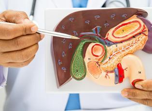 Hazımsızlık deyip geçmeyin! Altında safra kesesi taşı olabilir 