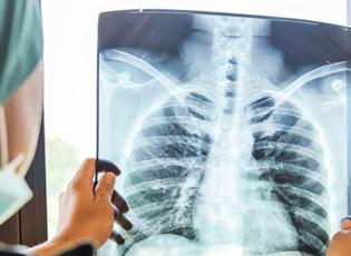 Tekrarlayan zat&uuml;rreyi hafife almayın: Kanser belirtisi olabilir!