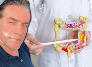 Murat Cemcir'i yoğun bakımlık eden hastalık divertik&uuml;l kanaması nedir?