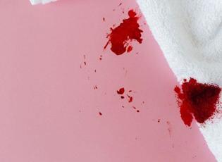 Hemoroid deyip ge&ccedil;meyin: Kanama hayati bir hastalığın sinyali olabilir!