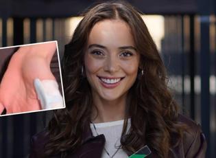 Rabia Soyt&uuml;rk sette kaza ge&ccedil;irdi! Parmağı kopma noktasına geldi