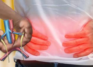 At nalı b&ouml;brek: Her 400 doğumda g&ouml;r&uuml;len belirti vermeyen b&ouml;brek anomalisi ve riskleri