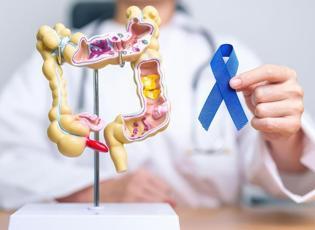 Kanser tedavisinde g&ouml;r&uuml;nmeyen destek&ccedil;i: Sağlıklı mikrobiyota