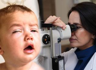 Uzmanı a&ccedil;ıkladı: Bu masaj g&ouml;zyaşı kanalı tıkanıklığını a&ccedil;abiliyor