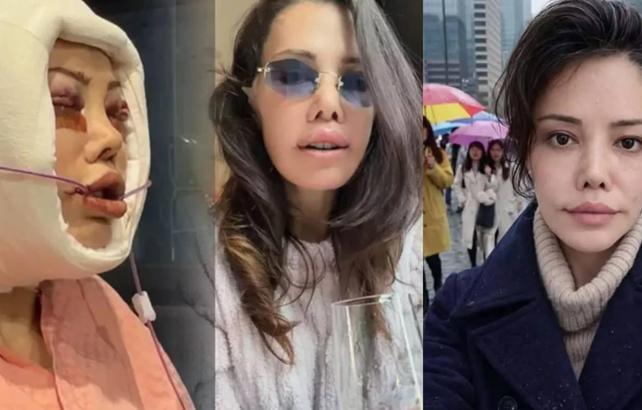 Kore'de y&uuml;z nakli sonrası &ouml;l&uuml;m dilekleriyle karşılaştı: Didem Ceran isyan etti