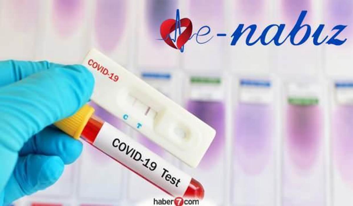 koronavirus test sonucu kac gunde cikar e nabiz covid 19 pcr test sonucu nasil sorgulanir saglik haberleri