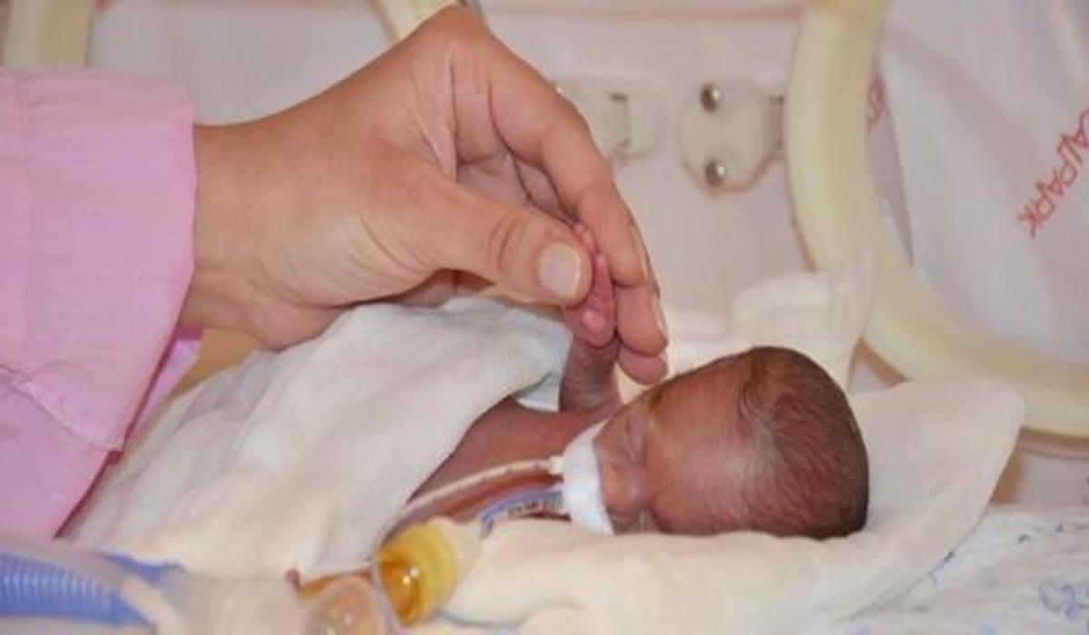 380 gram dogan bebegine 1 ay sonra ilk dokunus anne cocuk haberleri