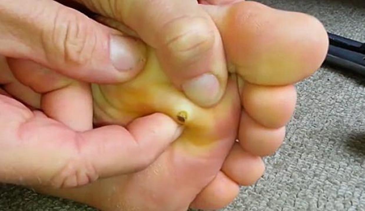 Ayak Sigilinden Nasil Kurtulunur Video 7 Ayak Sigilinden Nasil Kurtulunur Video 7