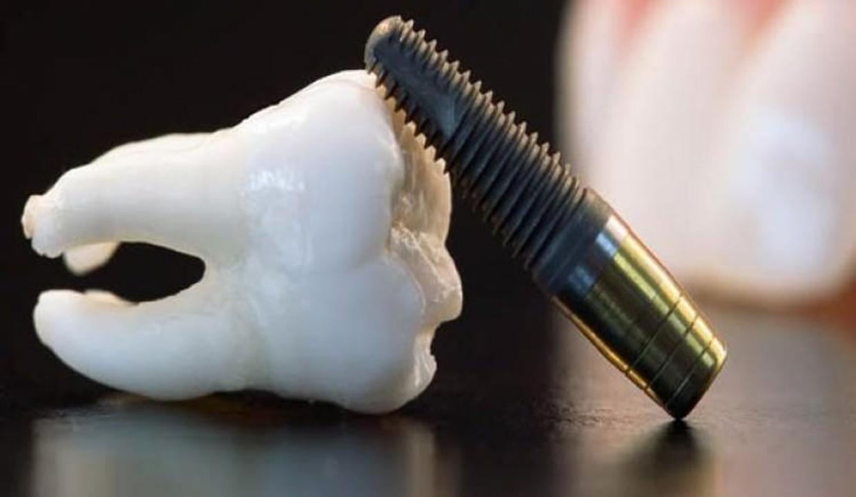 Sahte implant tehlike saçıyor